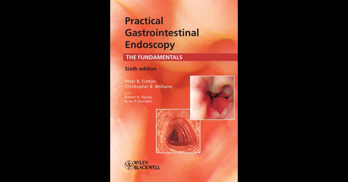 Gastroenterological endoscopy, 2e