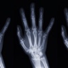 X-Ray камера + молчаливый