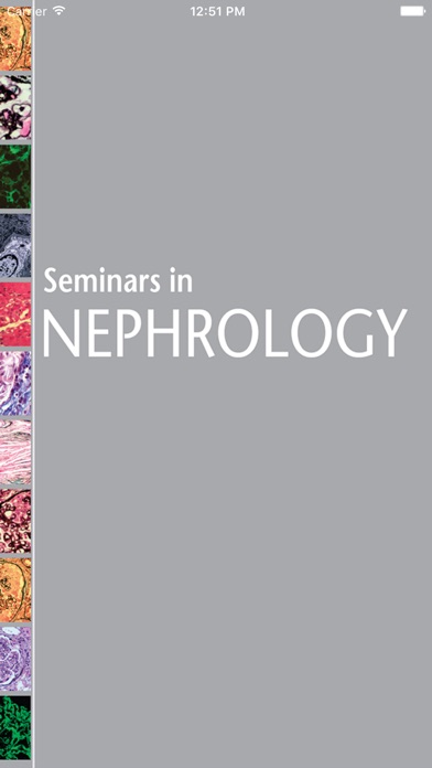 Seminars in Nephrology screenshot1