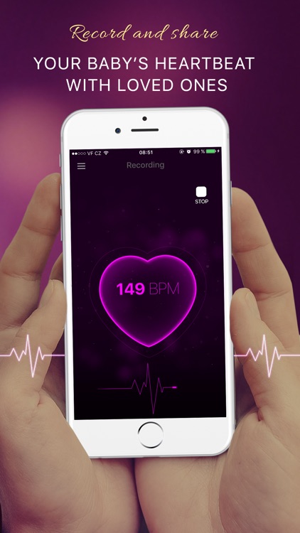 iphone baby heartbeat monitor