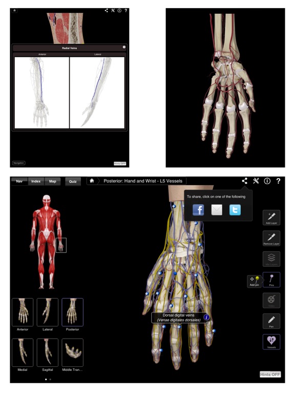 Hand Wrist Pro III - iPad Screenshots