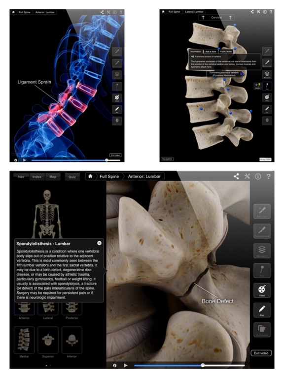 Spine Pro III Screenshots