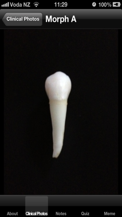 tooth morphology exam preparation by abdulla alajmi tooth morphology