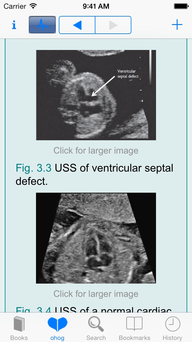 Oxford Handbook of Obstetrics and Gynaecology, Second Edition screenshot 3