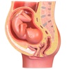 Fetus in the Uterus 3D
